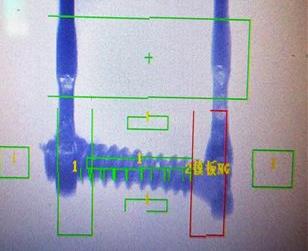 保險絲焊接缺陷檢測